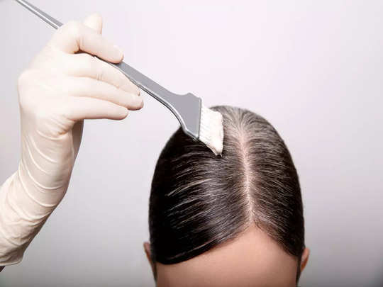 Causes of Young-Age Grey Hair