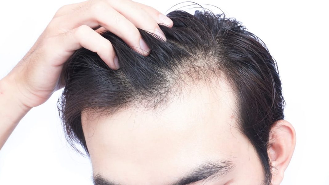 Omega-3 scalp health benefits